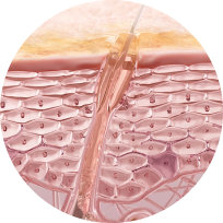 Skin mechanism