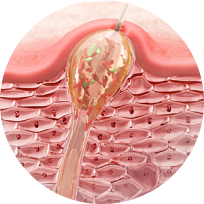 Skin mechanism