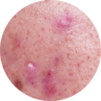 Clinical signs